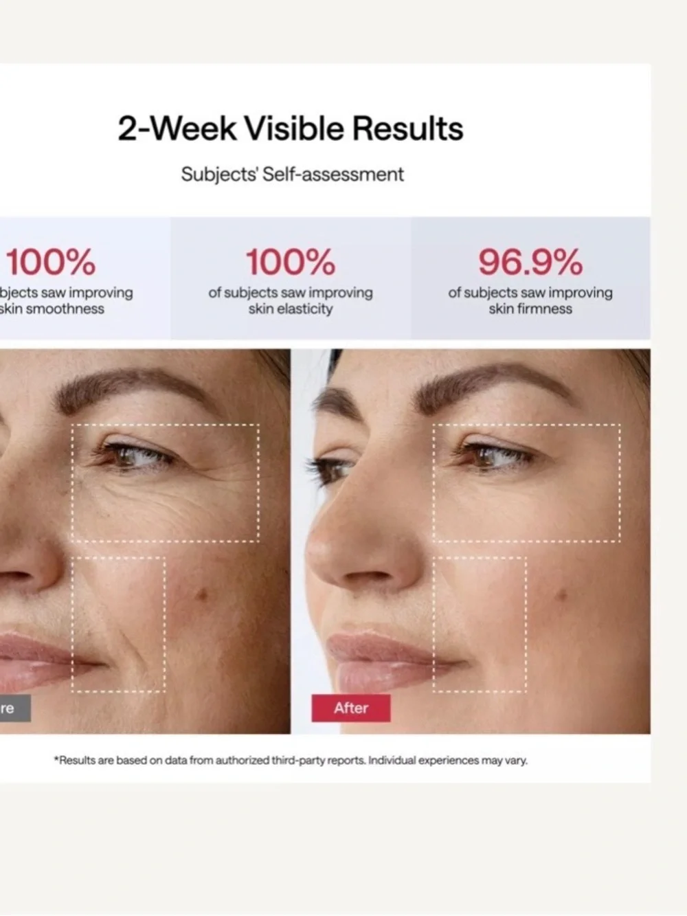 Ulike - JMOON Microcurrent & LED Facial Toning Device